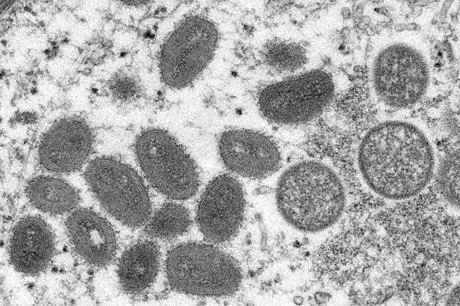 مدار الساعة,أخبار عربية ودولية,وزيرة الصحة,وزارة الصحة,منظمة الصحة العالمية