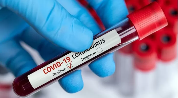 مدار الساعة,أخبار الأردن,اخبار الاردن,كورونا