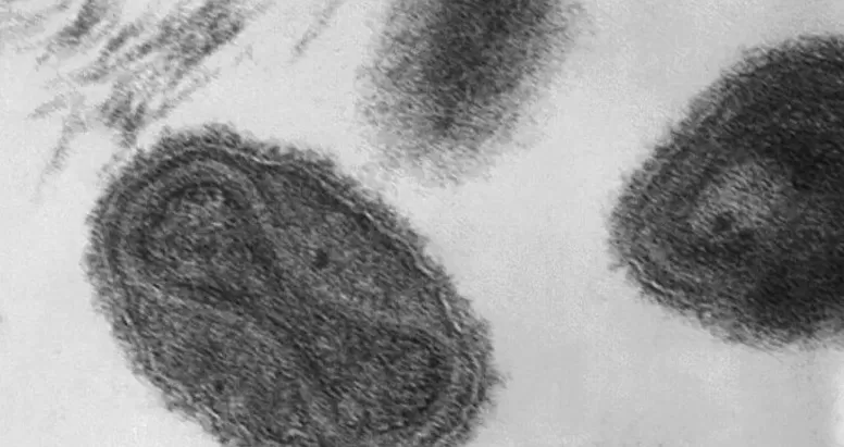 مدار الساعة,أخبار عربية ودولية,جدري القردة,منظمة الصحة العالمية