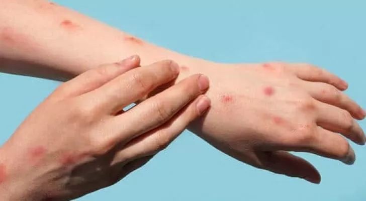 مدار الساعة,أخبار عربية ودولية,منظمة الصحة العالمية