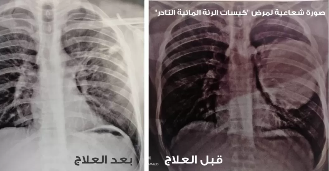 مدار الساعة,أخبار الأسرة,وزارة الصحة,وكالة الأنباء الأردنية