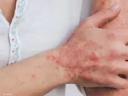 مدار الساعة,أخبار عربية ودولية,منظمة الصحة العالمية