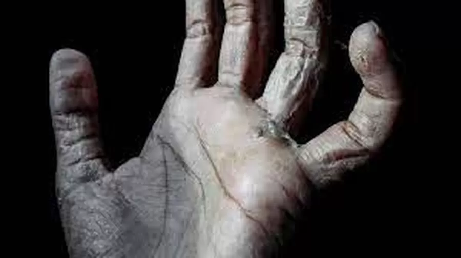 مدار الساعة,أخبار خفيفة ومنوعة,وزارة الصحة