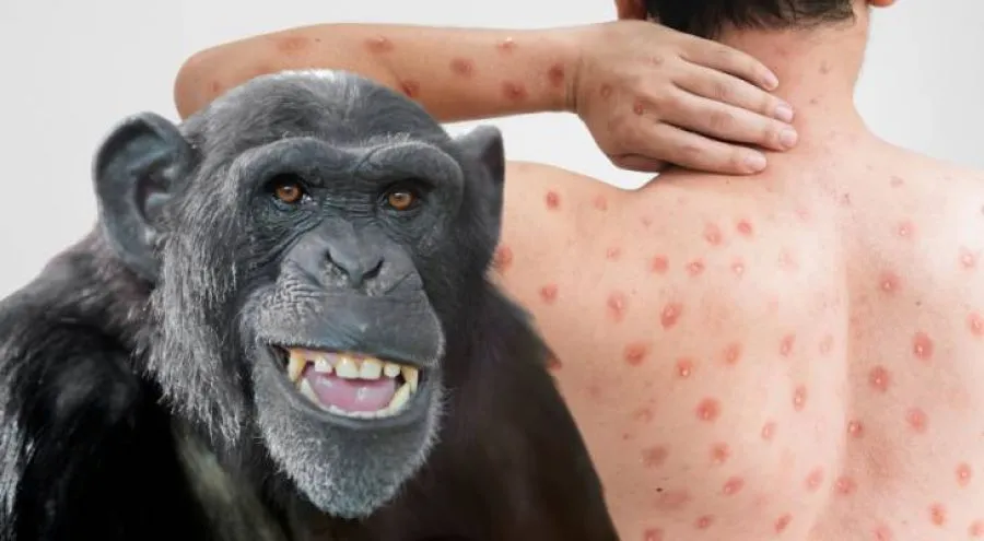 مدار الساعة,أخبار الأردن,اخبار الاردن,المركز الوطني لمكافحة الأوبئة,كورونا,وزارة الصحة,المركز الوطني للأمن وإدارة الأزمات