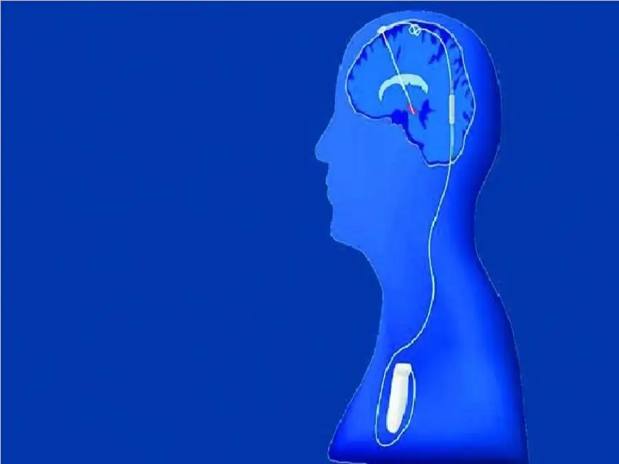 مدار الساعة,أخبار الأسرة