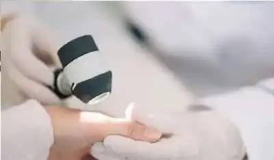 قريبا.. اختبار منزلي بسيط لسرطان الجلد