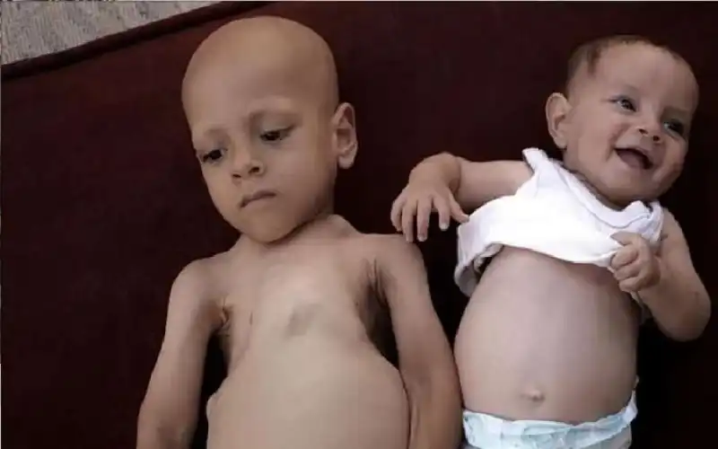 مدار الساعة,أخبار الأسرة,قطاع غزة