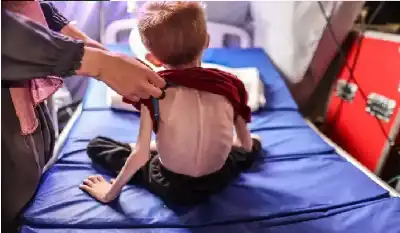 تاريخ التجويع.. . الإبادة في غزة