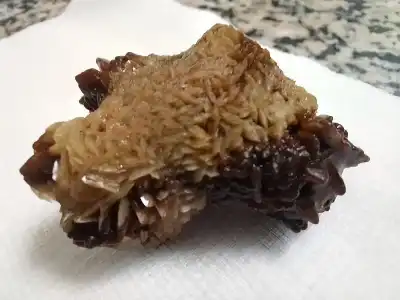 الأردن: عملية نوعية لاستخراج حصوة كبيرة