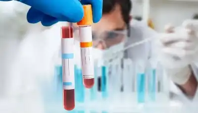 ولادة جديدة للأمل: تقنية دم متطورة