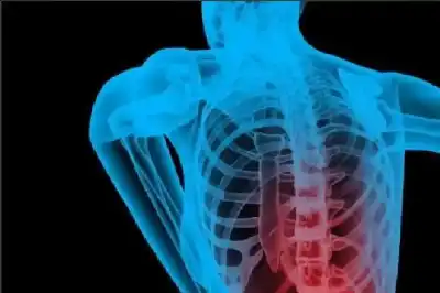 تخلص من آلام ظهرك في 45