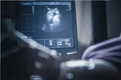 كانوا ينتظرون مولودا.. اللحظة التي صعقت