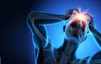 المسكنات تزيد ألمك بدائل طبيعية للصداع