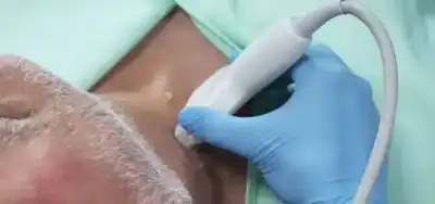 فحص بسيط يكشف خطر الإصابة بالنوبات