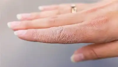 جلدك يصرخ بالإنذار: لا تتجاهل هذه