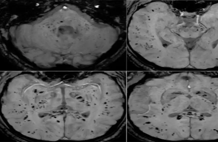 مدار الساعة,أخبار الصحة والأسرة,منظمة الصحة العالمية