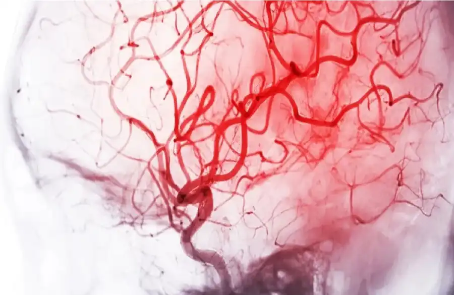 مدار الساعة,أخبار الصحة والأسرة,الذكاء الاصطناعي