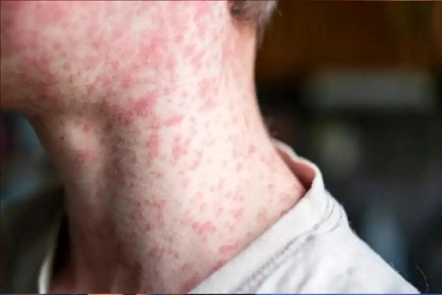 مدار الساعة,أخبار الصحة والأسرة,كورونا,منظمة الصحة العالمية,عطلة رسمية