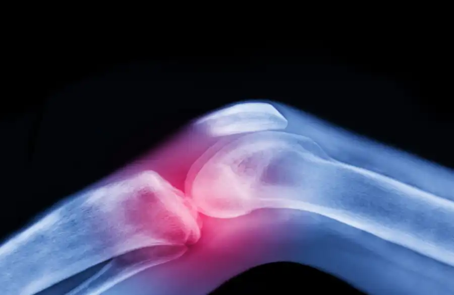 مدار الساعة,أخبار عربية ودولية,أخبار الصحة والأسرة