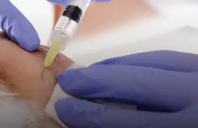 السعودية تحظر حقن التجميل.. وتعطي مهلة
