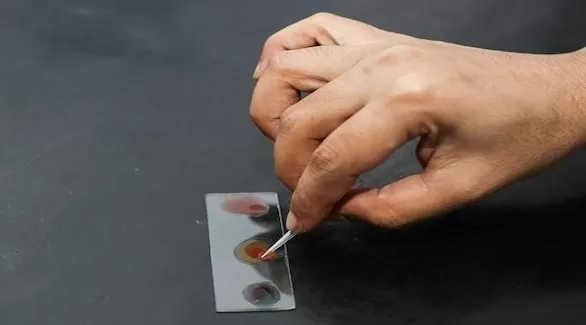 مدار الساعة,أخبار خفيفة ومنوعة,كورونا,منظمة الصحة العالمية