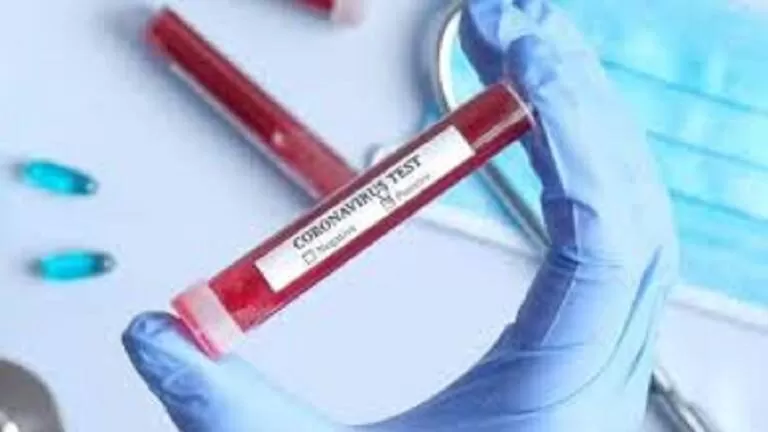 مدار الساعة,أخبار خفيفة ومنوعة,كورونا