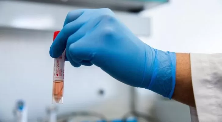 مدار الساعة,أخبار خفيفة ومنوعة,كورونا,وزارة الصحة