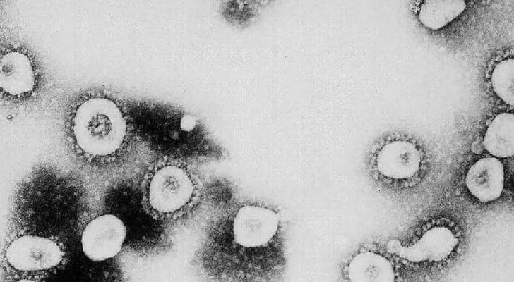 مدار الساعة,أخبار خفيفة ومنوعة,كورونا