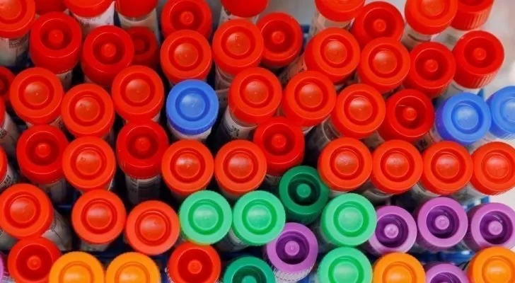 مدار الساعة,أخبار خفيفة ومنوعة,كورونا,كوفيد 19