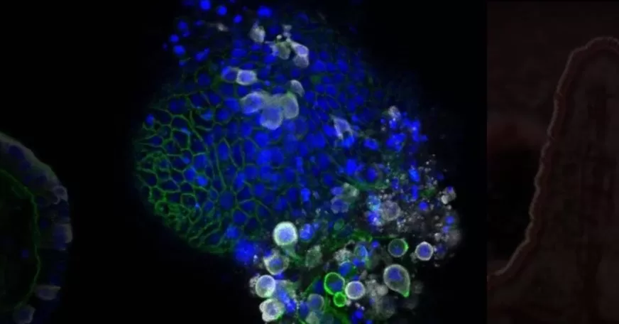 مدار الساعة,أخبار عربية ودولية,كورونا