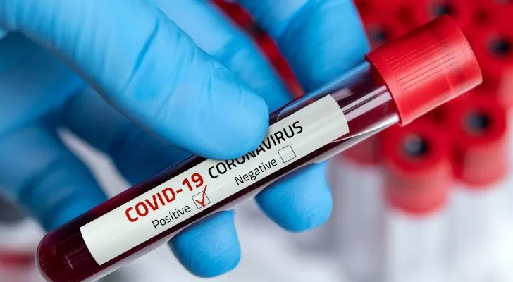 مدار الساعة,أخبار خفيفة ومنوعة,كورونا