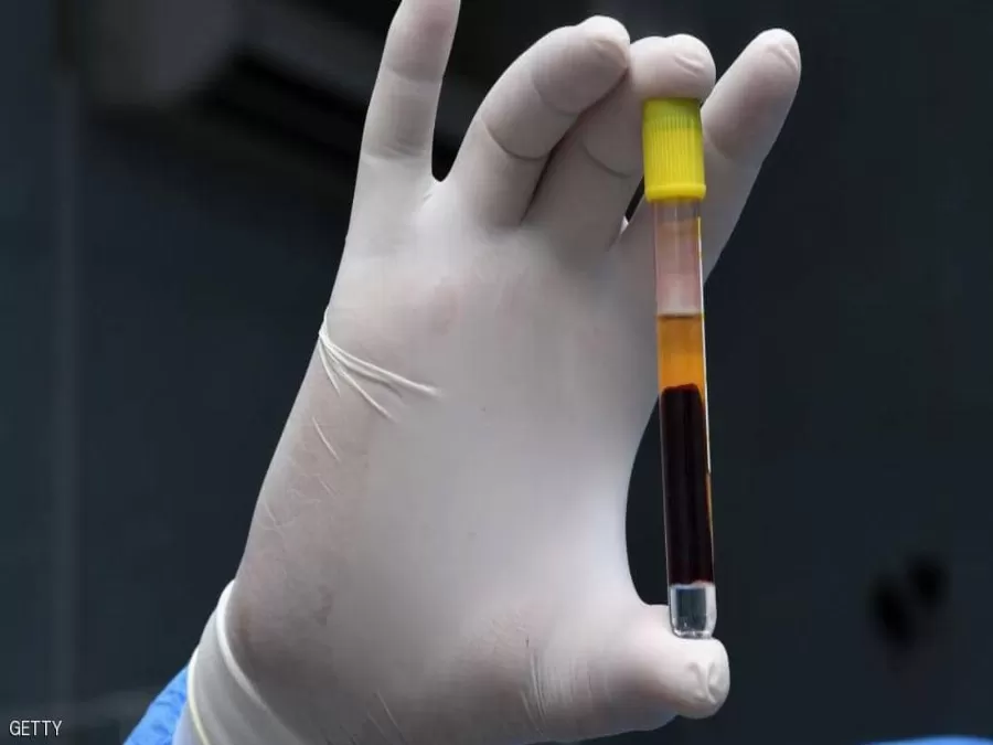 مدار الساعة,أخبار عربية ودولية,كورونا