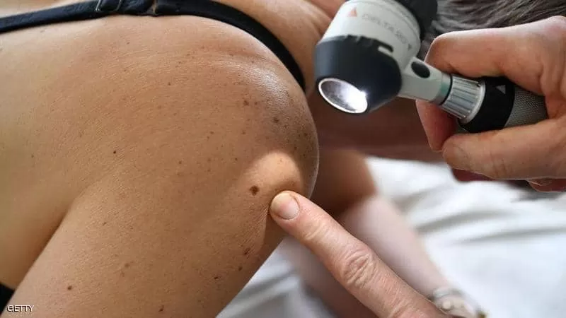 مدار الساعة,أخبار خفيفة ومنوعة,كورونا