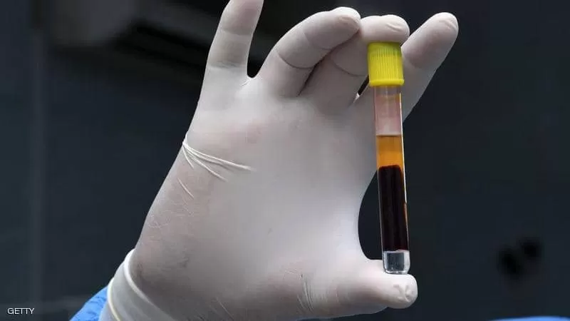 مدار الساعة,أخبار خفيفة ومنوعة,كورونا,كوفيد 19