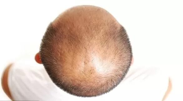 مدار الساعة,أخبار خفيفة ومنوعة,كورونا