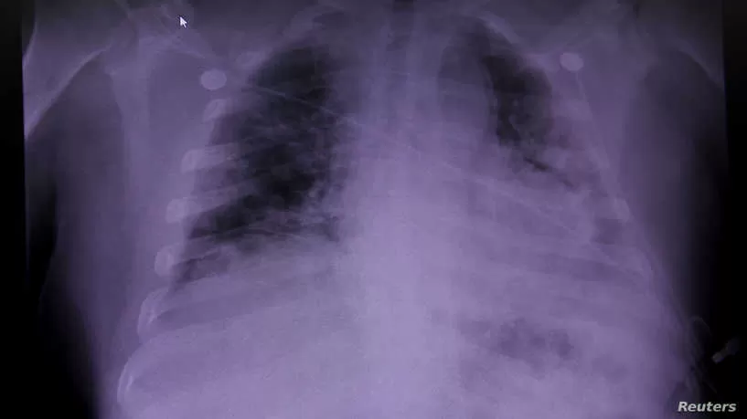 مدار الساعة,أخبار خفيفة ومنوعة,كورونا