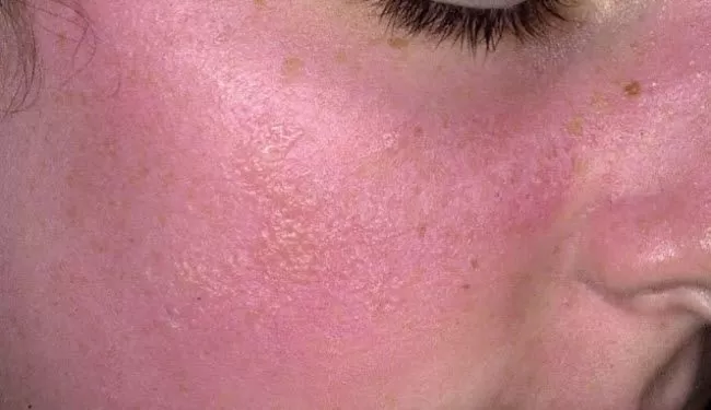 مدار الساعة,أخبار خفيفة ومنوعة,درجات الحرارة