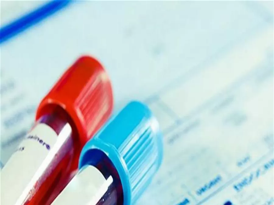 مدار الساعة,أخبار اقتصادية,وزير الصحة,كورونا