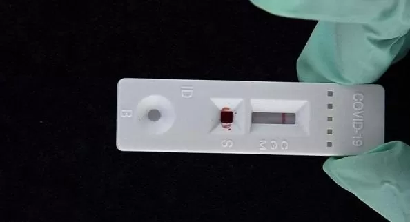 مدار الساعة,أخبار خفيفة ومنوعة,كورونا