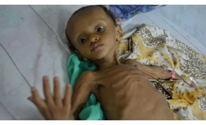 مدار الساعة,أخبار عربية ودولية,منظمة الصحة العالمية