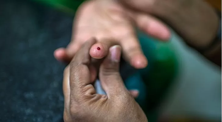 مدار الساعة,أخبار عربية ودولية,منظمة الصحة العالمية