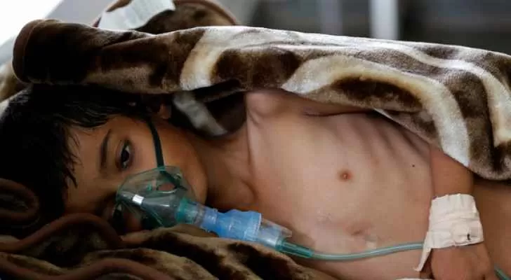 مدار الساعة,أخبار عربية ودولية,منظمة الصحة العالمية,الأمم المتحدة