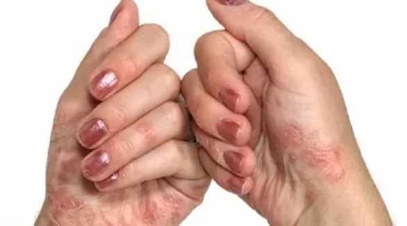 مدار الساعة,أخبار خفيفة ومنوعة,كورونا,منظمة الصحة العالمية