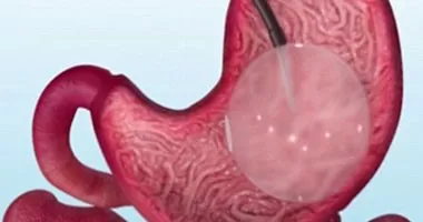 مدار الساعة,أخبار الأسرة