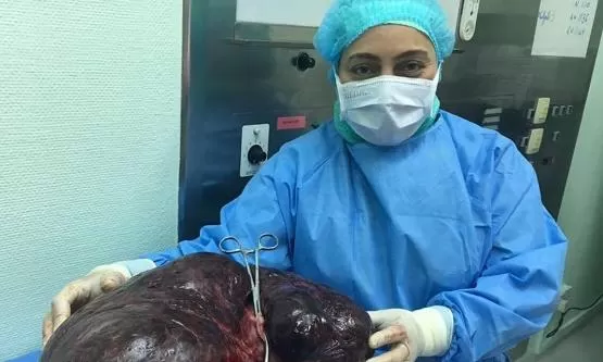 مدار الساعة,أخبار خفيفة ومنوعة