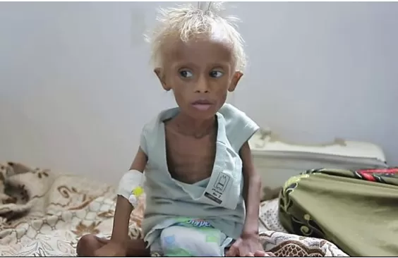 مدار الساعة,أخبار عربية ودولية,الأمم المتحدة