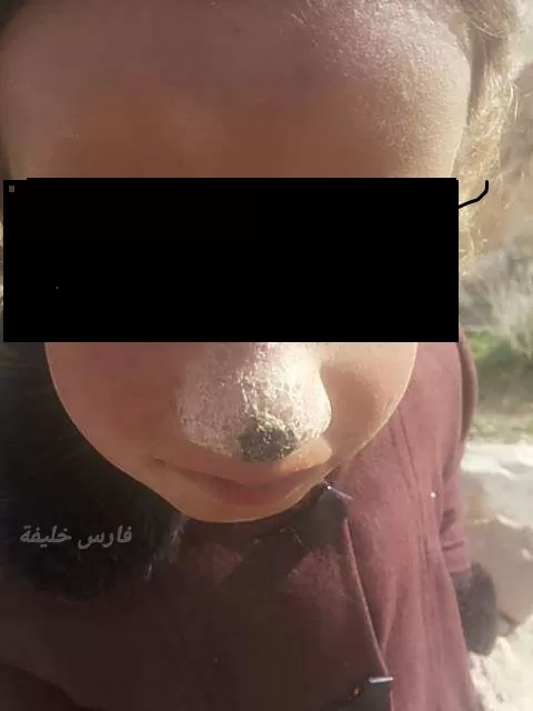 مدار الساعة,أخبار الأردن,اخبار الاردن,وزير الصحة