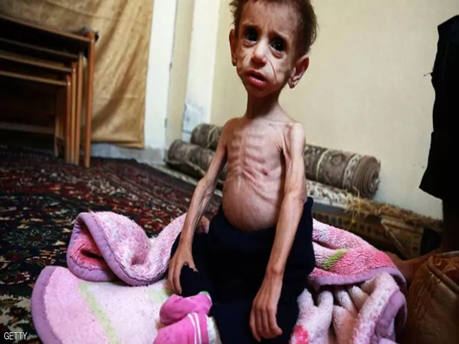 مدار الساعة,أخبار عربية ودولية,الأمم المتحدة,يونيسيف