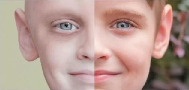 مدار الساعة,أخبار عربية ودولية,منظمة الصحة العالمية