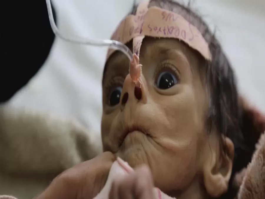 مدار الساعة,أخبار عربية ودولية,الأمم المتحدة,يونيسيف